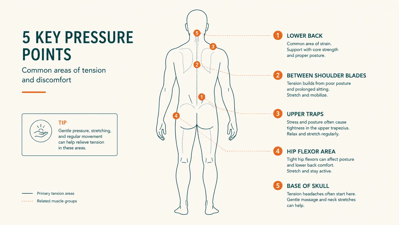Simple body map chart showing the five common trigger point zones that flare up after long shifts